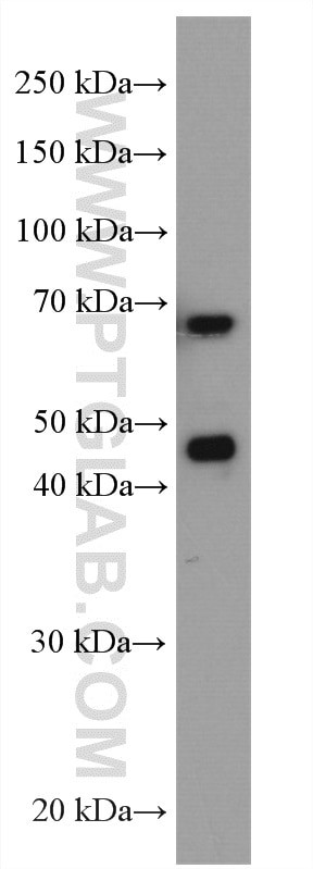 NRF1/nuclear respiratory factor 1 Antibody in Western Blot (WB)