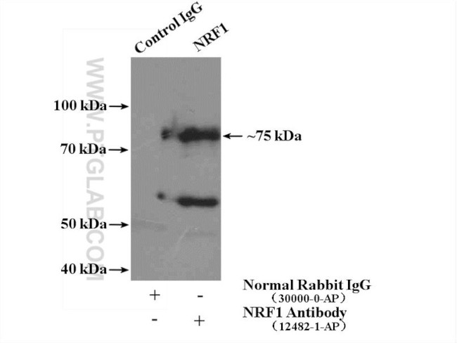 NRF1/nuclear respiratory factor 1 Antibody in Immunoprecipitation (IP)