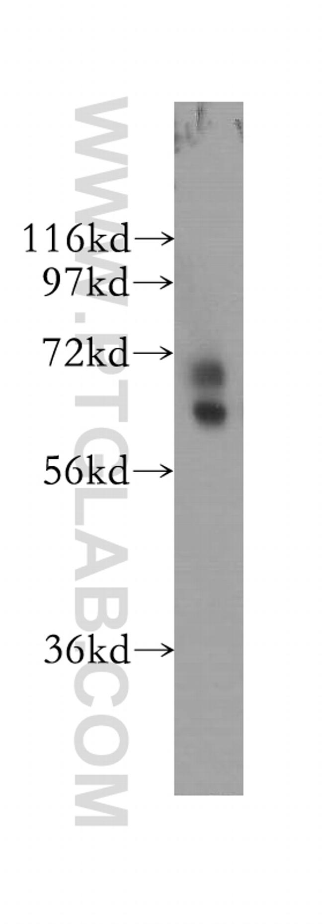 NRF1/nuclear respiratory factor 1 Antibody in Western Blot (WB)