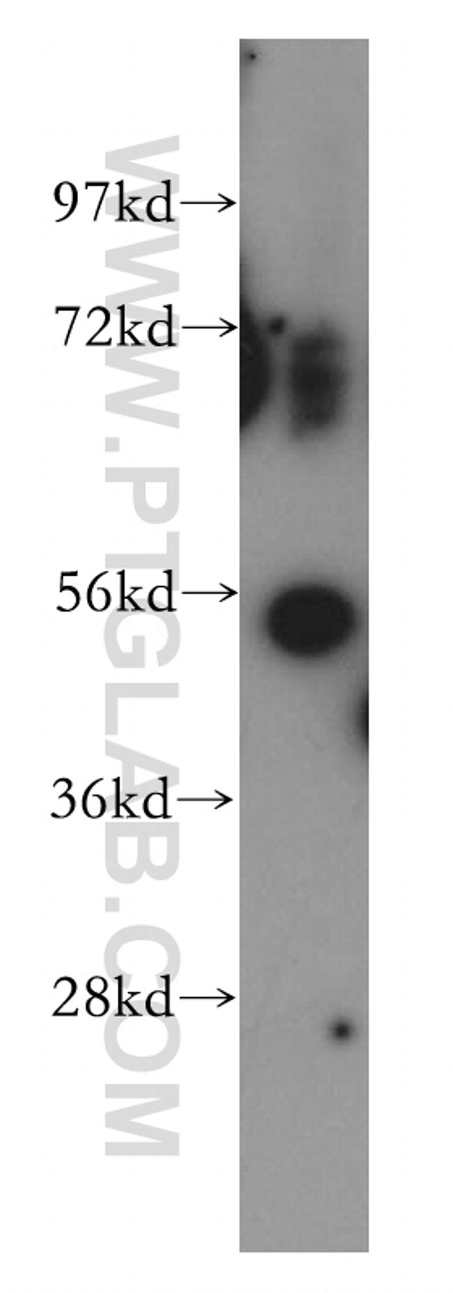 PDCD7 Antibody in Western Blot (WB)