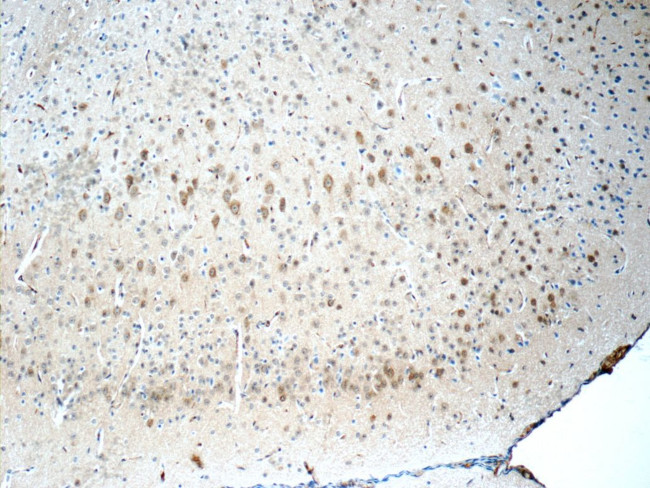 CYP46A1 Antibody in Immunohistochemistry (Paraffin) (IHC (P))