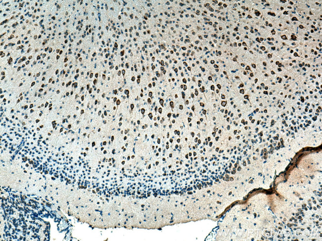 CYP46A1 Antibody in Immunohistochemistry (Paraffin) (IHC (P))