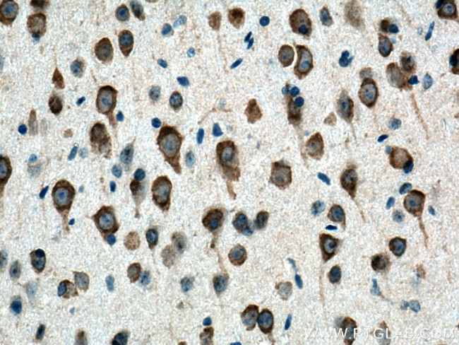 CYP46A1 Antibody in Immunohistochemistry (Paraffin) (IHC (P))