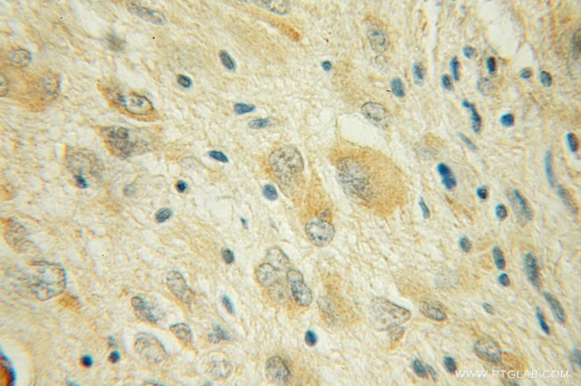 CYP46A1 Antibody in Immunohistochemistry (Paraffin) (IHC (P))