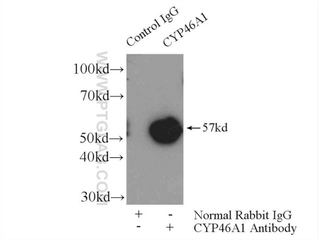 CYP46A1 Antibody in Immunoprecipitation (IP)