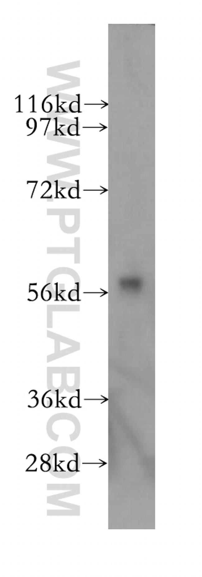 CYP46A1 Antibody in Western Blot (WB)