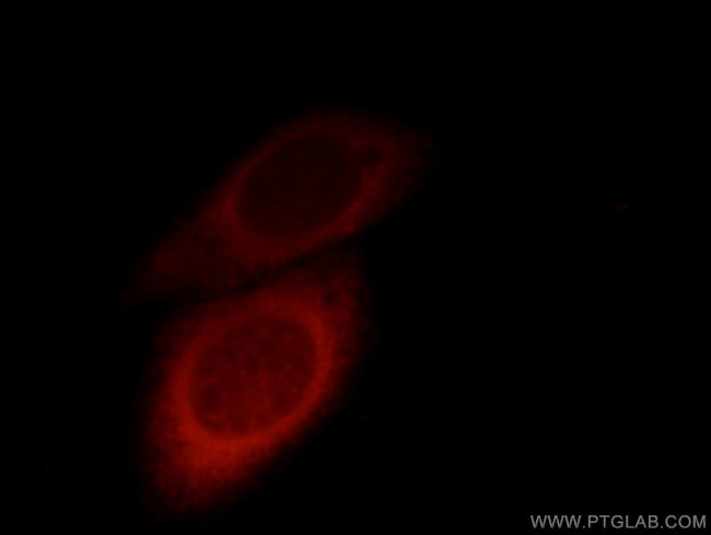 TBL2 Antibody in Immunocytochemistry (ICC/IF)