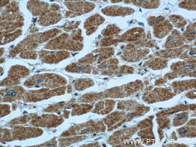 TBL2 Antibody in Immunohistochemistry (Paraffin) (IHC (P))