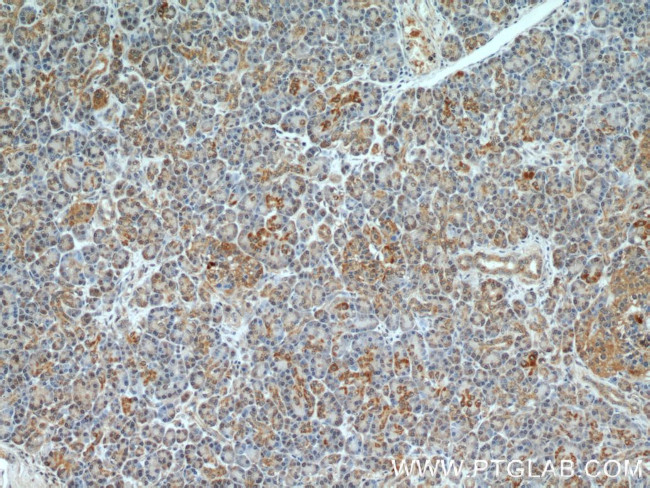 TBL2 Antibody in Immunohistochemistry (Paraffin) (IHC (P))