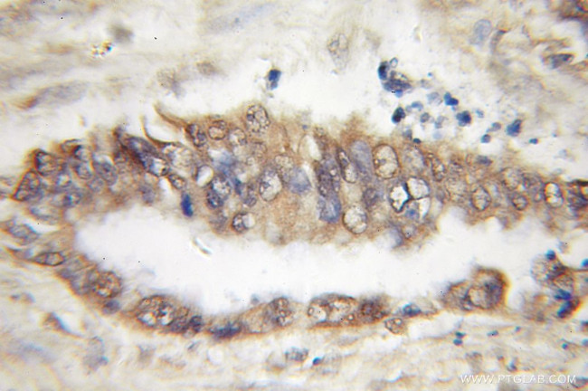 TBL2 Antibody in Immunohistochemistry (Paraffin) (IHC (P))