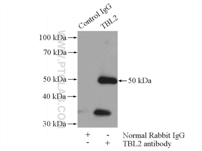 TBL2 Antibody in Immunoprecipitation (IP)