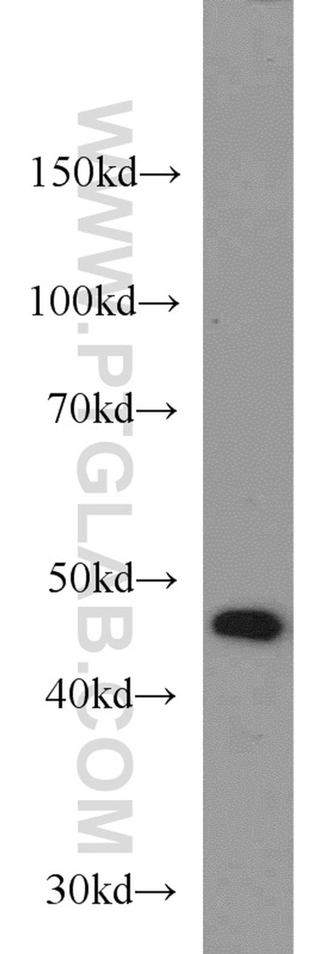 TBL2 Antibody in Western Blot (WB)