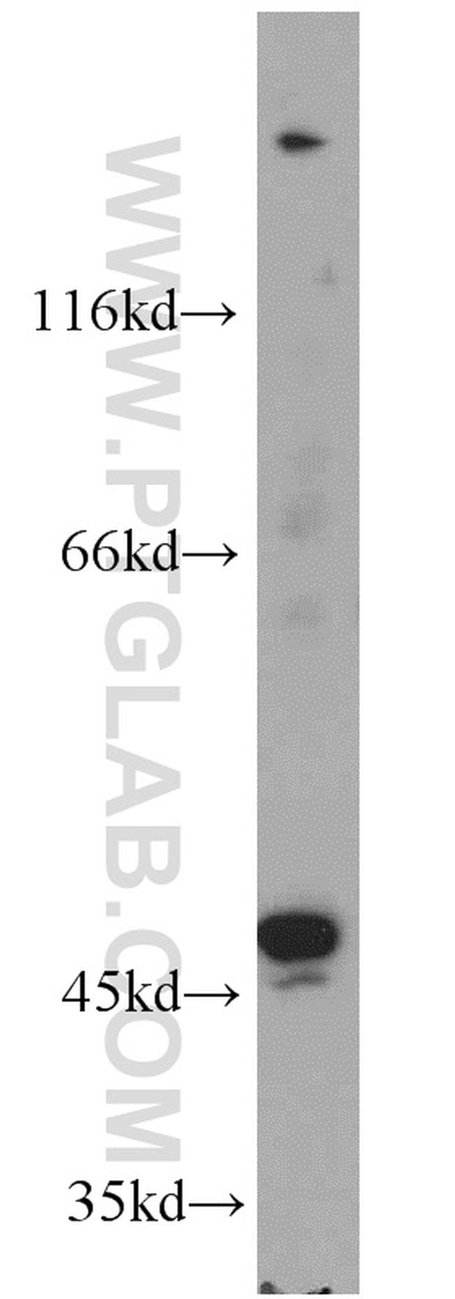 TBL2 Antibody in Western Blot (WB)