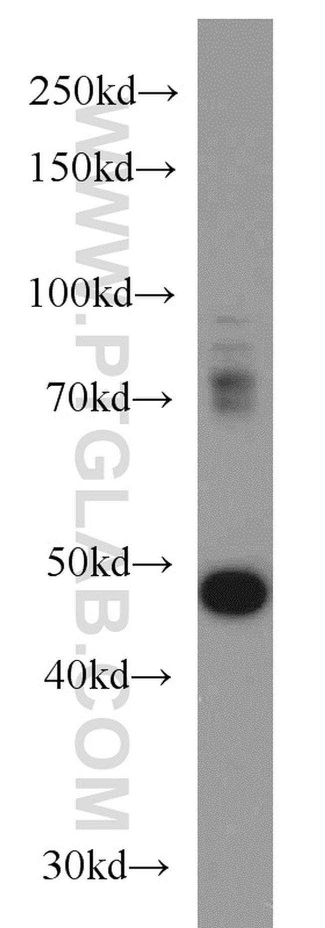 TBL2 Antibody in Western Blot (WB)