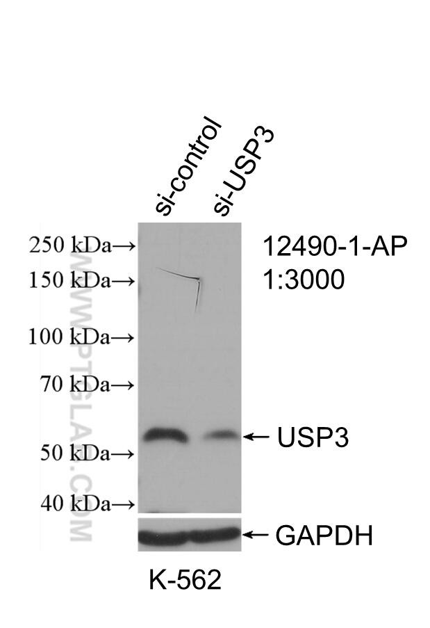 USP3 Antibody in Western Blot (WB)