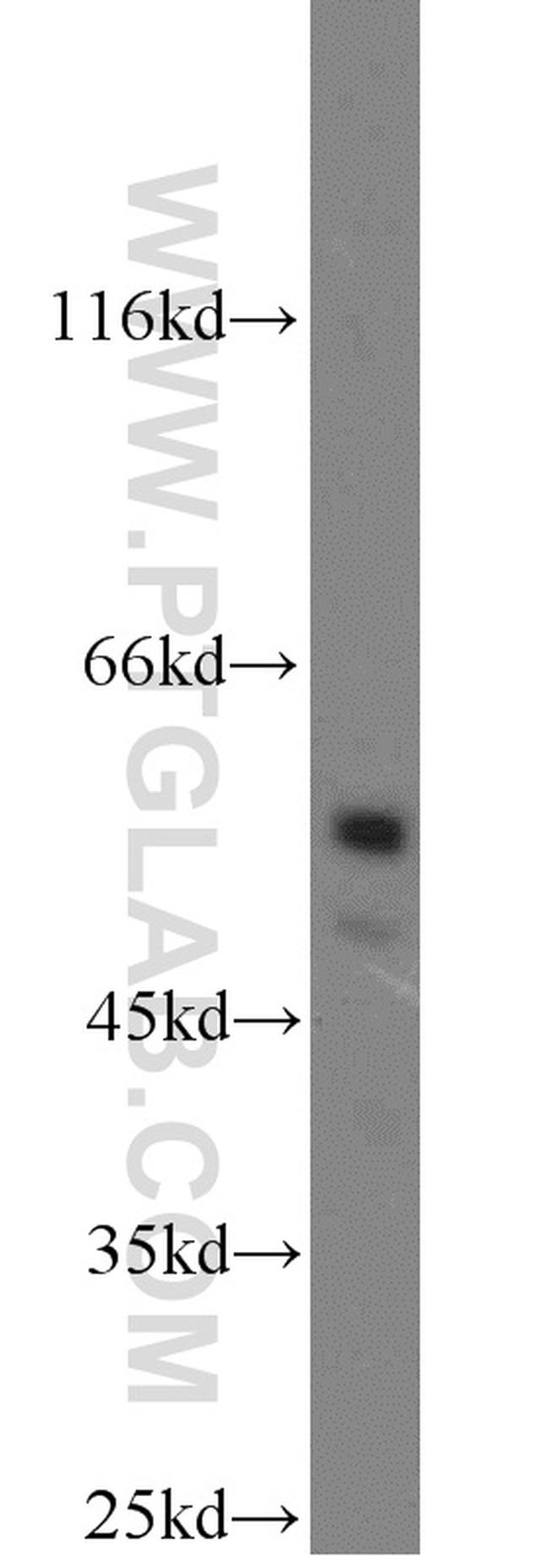 USP3 Antibody in Western Blot (WB)