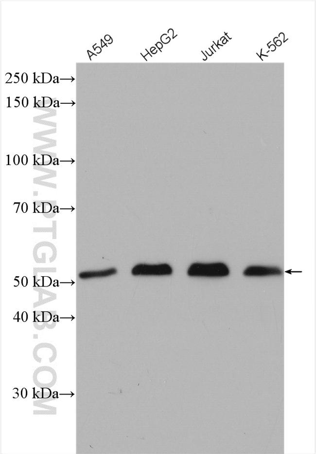 USP3 Antibody in Western Blot (WB)