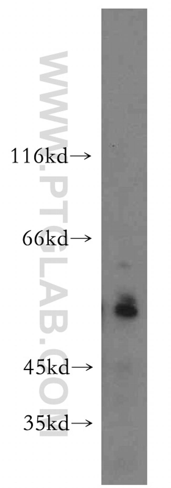 USP3 Antibody in Western Blot (WB)