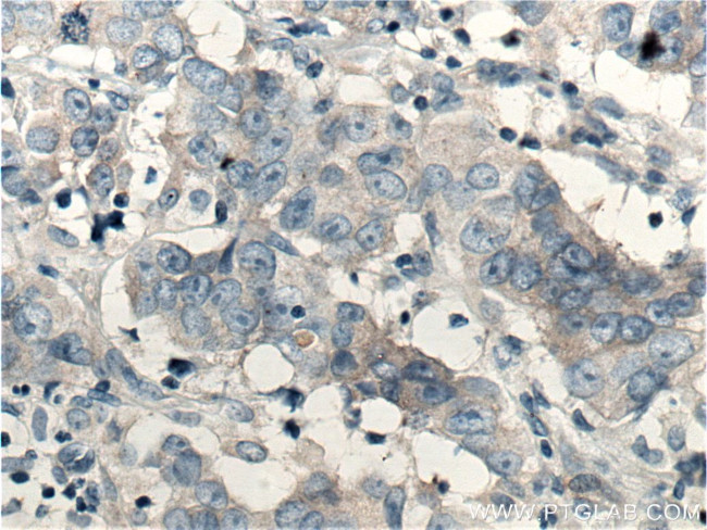 SGEF Antibody in Immunohistochemistry (Paraffin) (IHC (P))