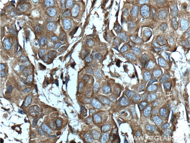 CD46 Antibody in Immunohistochemistry (Paraffin) (IHC (P))