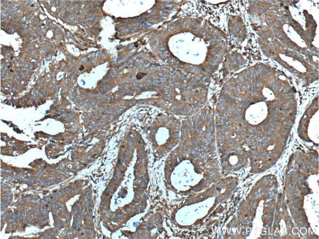 CD46 Antibody in Immunohistochemistry (Paraffin) (IHC (P))