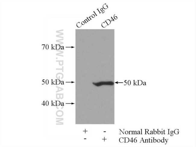 CD46 Antibody in Immunoprecipitation (IP)