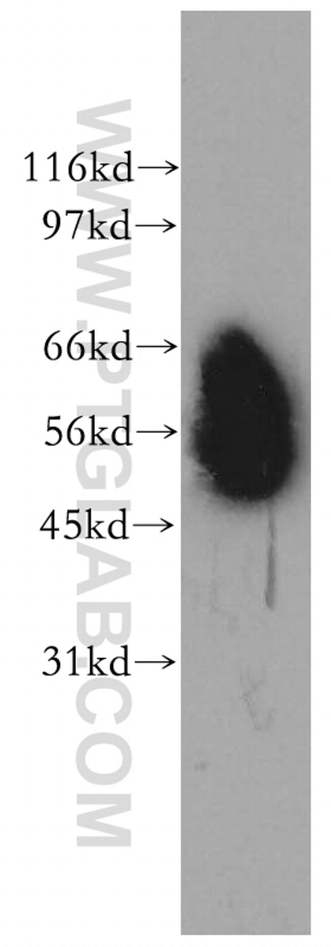 CD46 Antibody in Western Blot (WB)