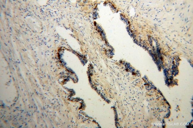 mu Crystallin Antibody in Immunohistochemistry (Paraffin) (IHC (P))