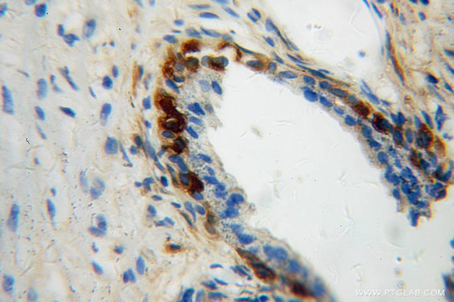 mu Crystallin Antibody in Immunohistochemistry (Paraffin) (IHC (P))