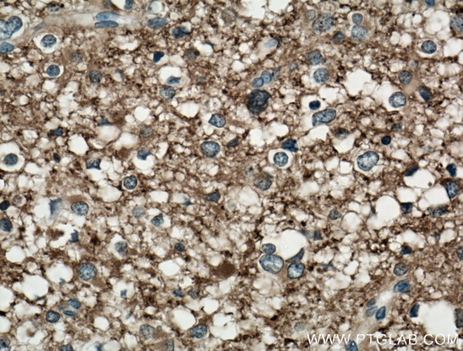 mu Crystallin Antibody in Immunohistochemistry (Paraffin) (IHC (P))