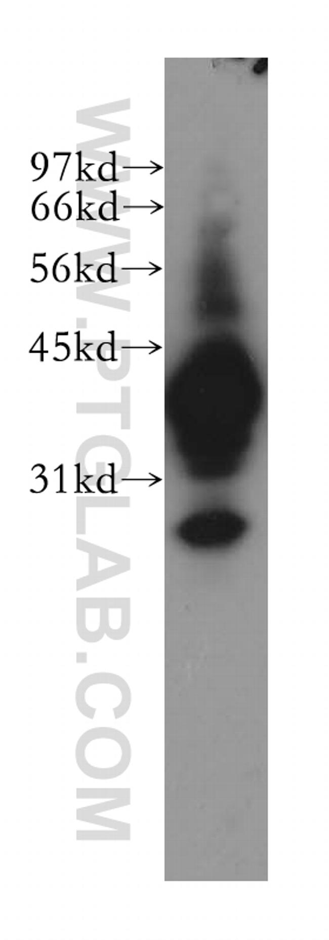 mu Crystallin Antibody in Western Blot (WB)