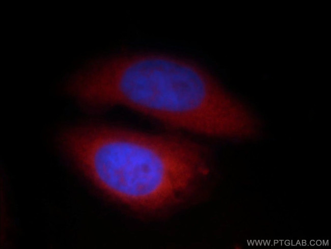 SHC Antibody in Immunocytochemistry (ICC/IF)