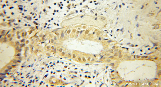 SHC Antibody in Immunohistochemistry (Paraffin) (IHC (P))