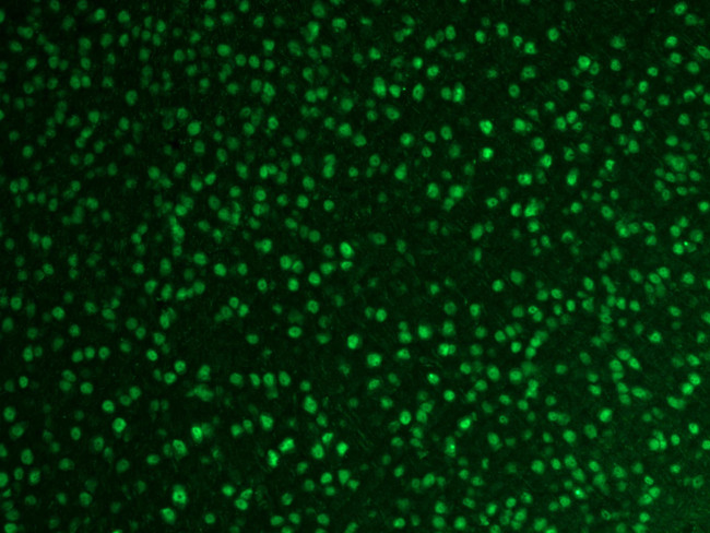 FOX2/RBM9 Antibody in Immunohistochemistry (Paraffin) (IHC (P))