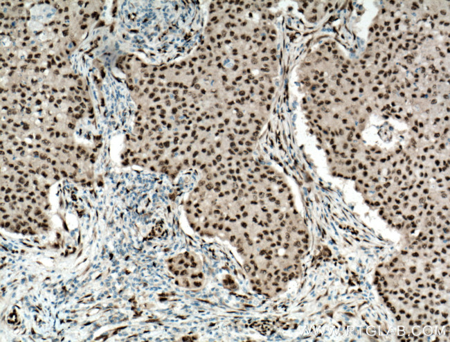 FOX2/RBM9 Antibody in Immunohistochemistry (Paraffin) (IHC (P))