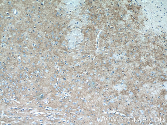 Kir4.1 Antibody in Immunohistochemistry (Paraffin) (IHC (P))