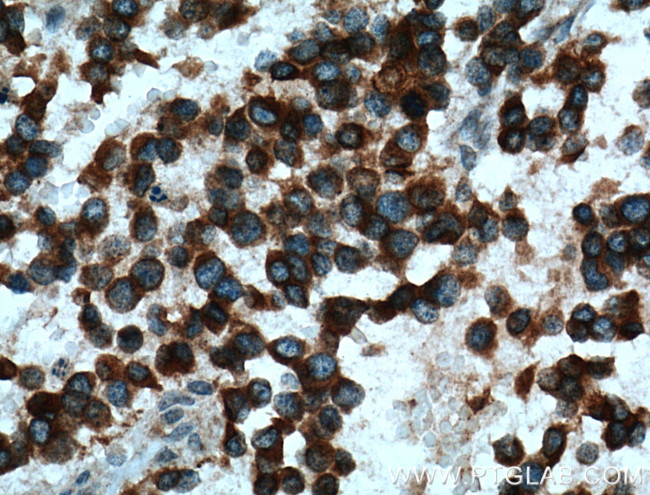 Kir4.1 Antibody in Immunohistochemistry (Paraffin) (IHC (P))