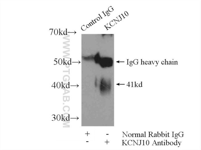 Kir4.1 Antibody in Immunoprecipitation (IP)