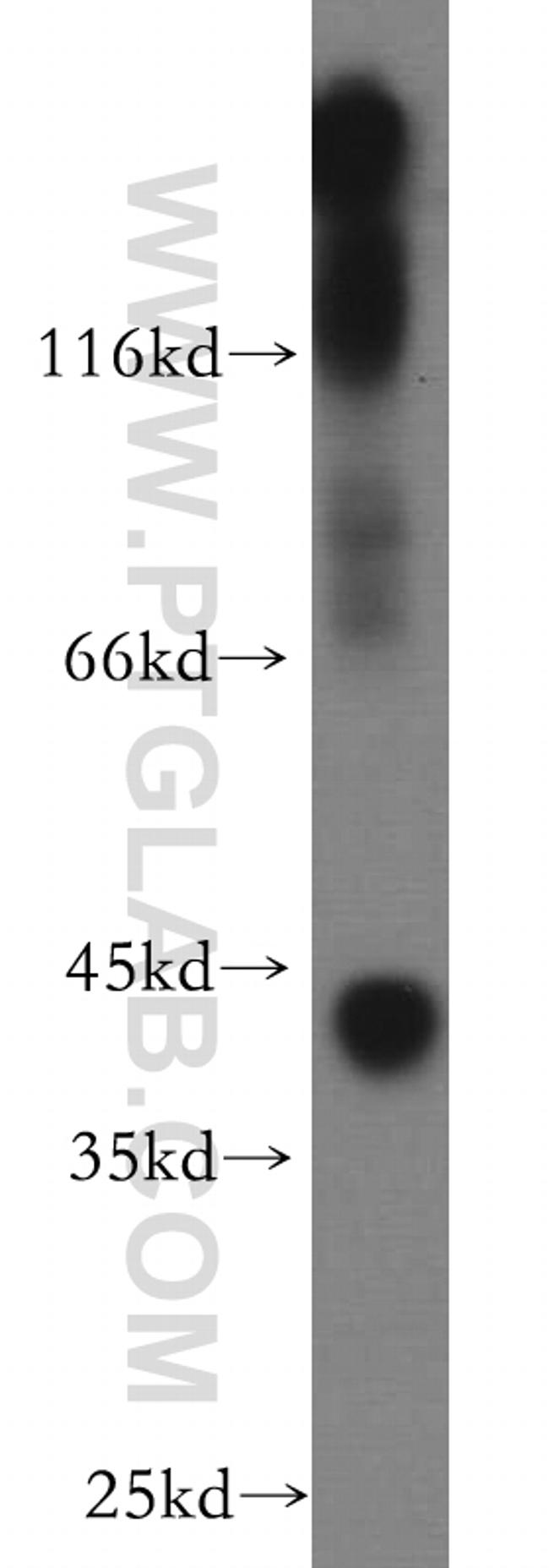 Kir4.1 Antibody in Western Blot (WB)