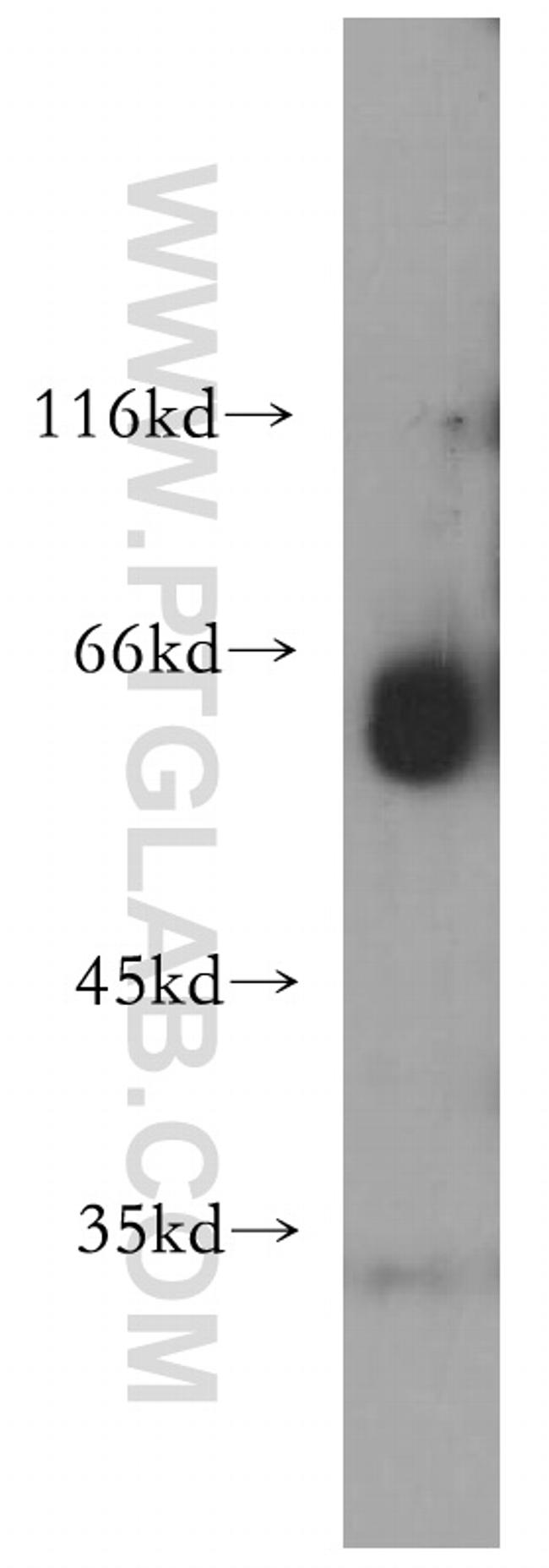 BBS8 Antibody in Western Blot (WB)