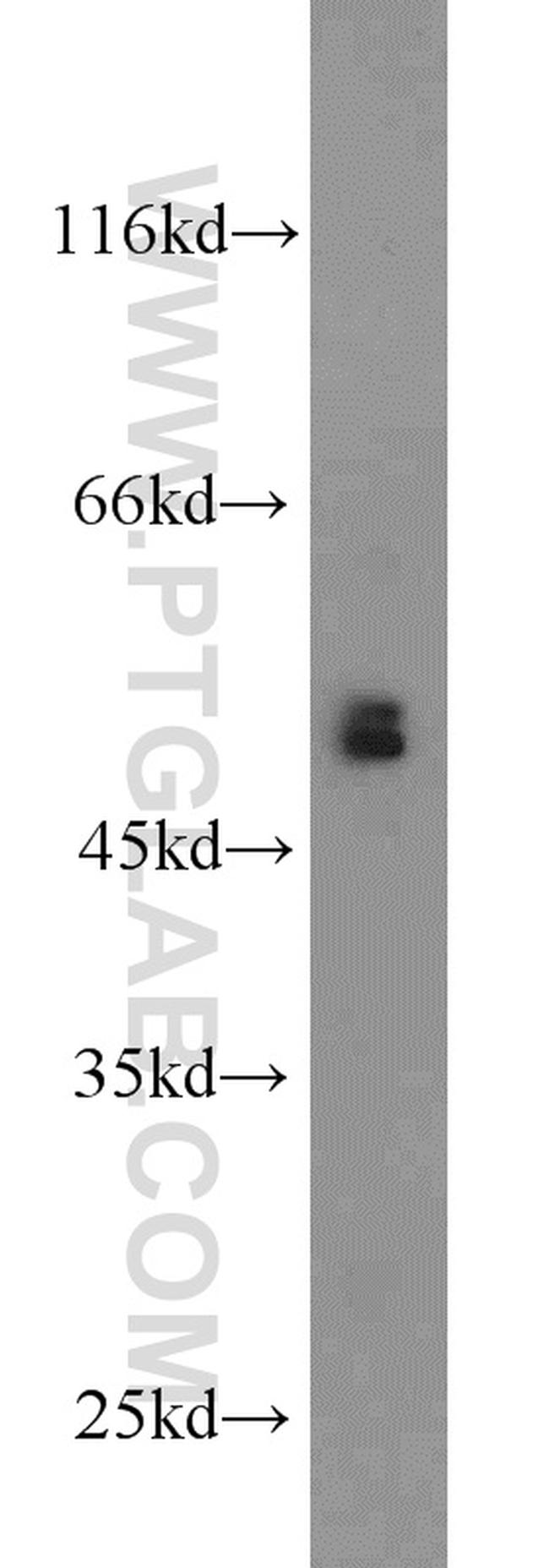 BBS8 Antibody in Western Blot (WB)