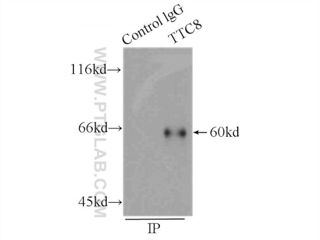 BBS8 Antibody in Immunoprecipitation (IP)