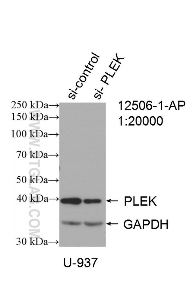 PLEK Antibody in Western Blot (WB)