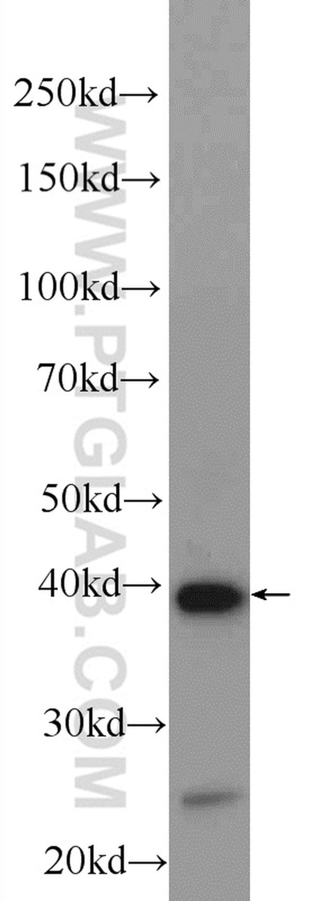 PLEK Antibody in Western Blot (WB)