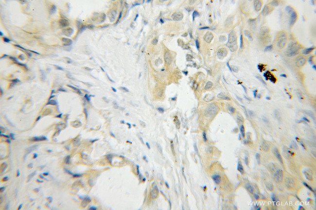 PLEK Antibody in Immunohistochemistry (Paraffin) (IHC (P))