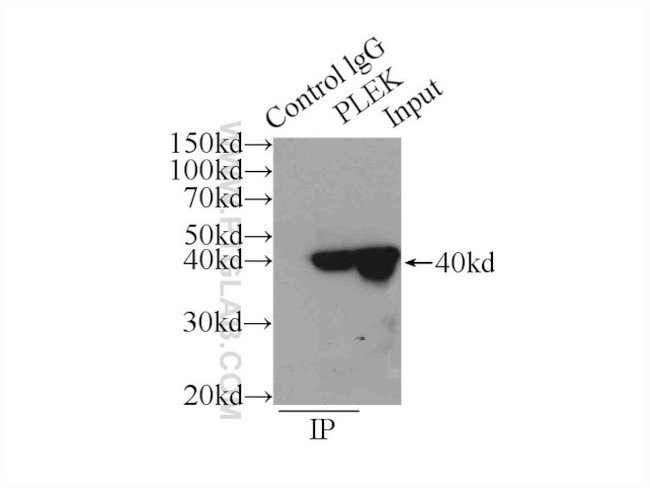 PLEK Antibody in Immunoprecipitation (IP)