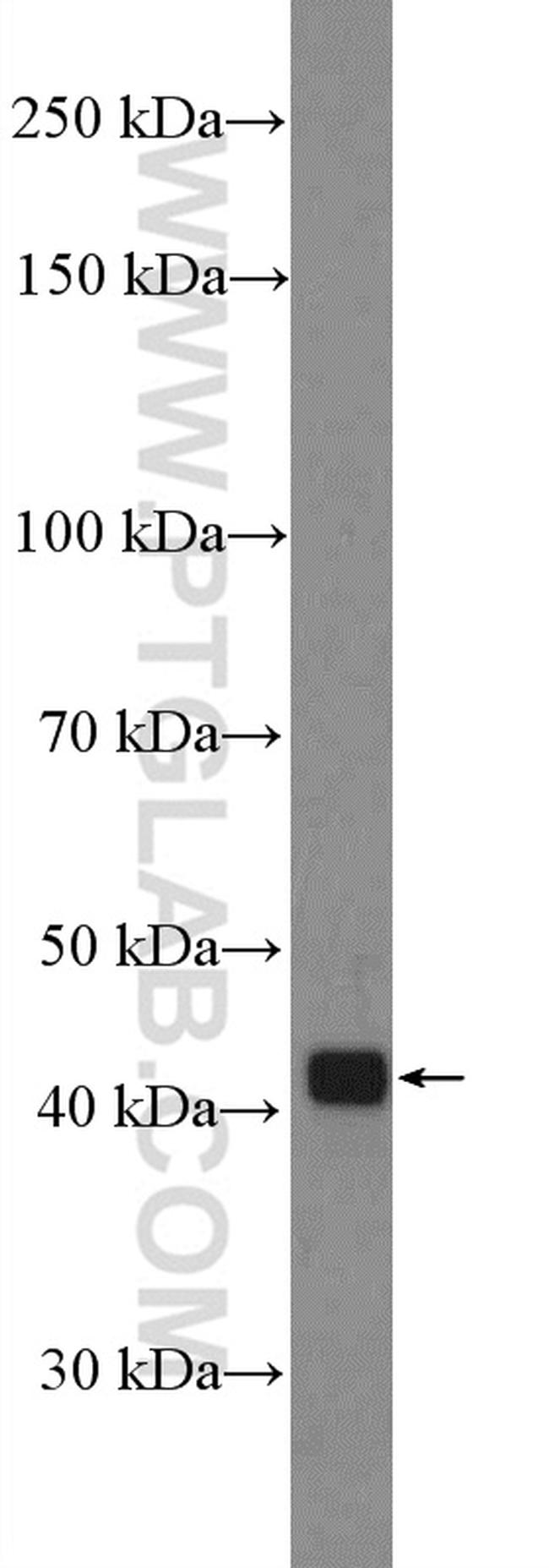 PLEK Antibody in Western Blot (WB)