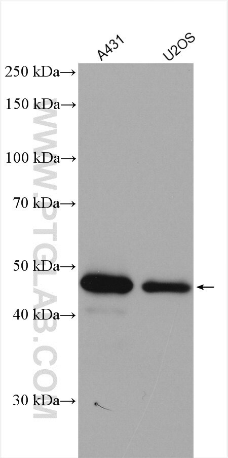 MAGEA4 Antibody in Western Blot (WB)