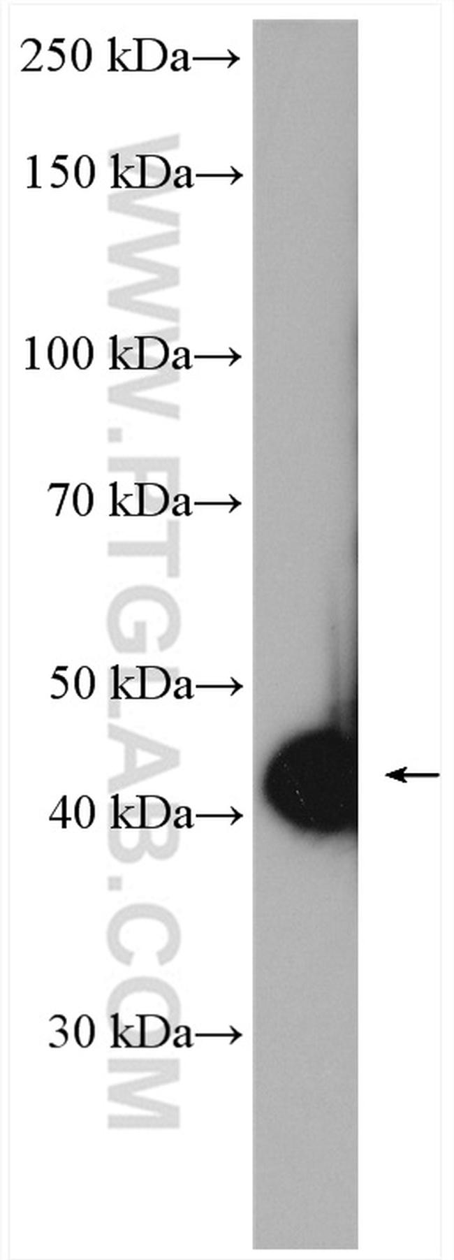 MAGEA4 Antibody in Western Blot (WB)