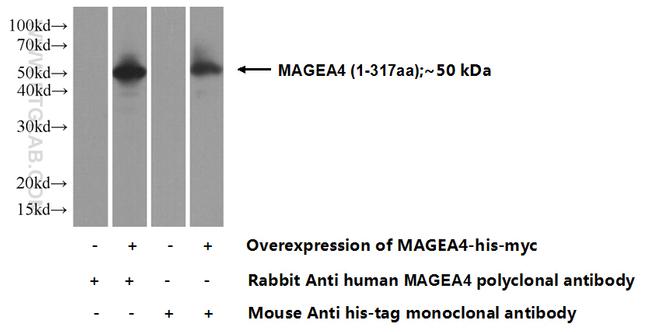 MAGEA4 Antibody in Western Blot (WB)